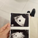부산 산부인과 | 서면 리오라여성의원 임신 후기