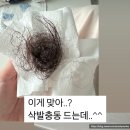 산후탈모 절망편) 모바르나 순환 토너, 바이브랩 스칼프, 루톤, 메디올 로스토닉