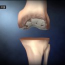 바른지성한방병원 네이버블로그
