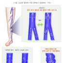 광주항외과의원 네이버블로그