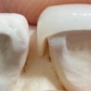 이건치과기공소 이미지