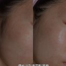 장원맨션 상가 앞 | 수성구 에스테틱 올리제뷰티에서 경산 시지 리프팅 윤곽
