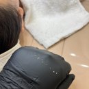 구암동182 | 대전 구암동 피부관리, 좁쌀 여드름 압출 받고 온 후기