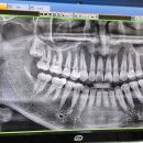 방화초이스치과의원 | 방화동 스케일링 초이스치과 진료시간