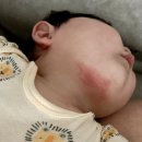 엠디메디칼 | 제로이드 인텐시브 크림 엠디 아기 피부 보습제 내돈내산 사용 후기