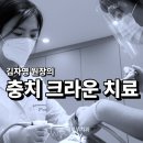 예부부치과의원 | 수하리 충치 크라운 치료 이천 연세부부 치과