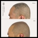 탈모왕 본점 이미지