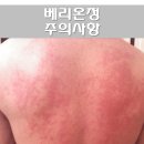 베리온베리