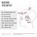 19. 안정피로(眼睛疲勞)-- 눈의 피로(疲勞)는 얼굴과 손등에 동전을 붙이고 이미지