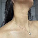 디어멍 | 청담동 의원 가로목주름 디어넥주사 내돈내산 1회차 후기