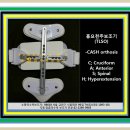 흉요천추보조기(TLSO)-케쉬보조기(CASH orthosis)-기성품 이미지