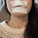 포왁싱 | [포왁싱] 용인 역북동 왁싱&속눈썹 전문샵 | 인중 왁싱 솔직 후기 | 가격 및 시술 정보