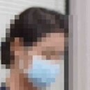 (주)자리 | 매부리코 성형 수술 입원기간 절차 차이점과 실제 후기 언제 회복될까?