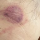 예람한의원 이미지