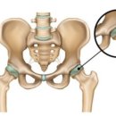 자세교정 필라테스 이미지