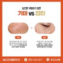 송도오라클피부과