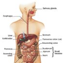 Intestinal obstruction 이미지