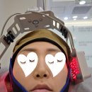 명인외과의원 | 항암 중 사랑니 발치