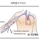 (주)대전골든타임응급환자이송센터 | [후기] 단국대학교병원 외상센터 입원 후기 / 팔 복합골절 수술 및 회복 후기 / 골절 재활 후기