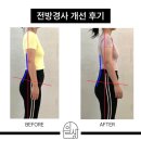 서울운동교정센터