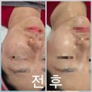 두정동 피부관리실 오마주21스킨케어 여름이벤트 받고 속건조 관리 후기(내돈내산)