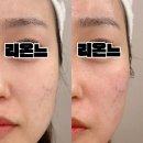1769 | 대구서구피부관리추천, 대구서구리프팅 추천 ) 리온느