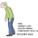 보행 운동 장애[Abnormalities of gait and mobility]뇌신경정신질환 이미지