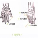 월오사암침법 근육통 치료 이미지