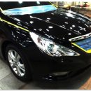 덴트렉스 이미지