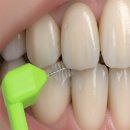 포유덴탈 이미지