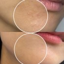 세포삼거리 | 신대방삼거리 피부관리 파브온스킨 10월 이벤트 2번, 한 달에 단 4번 피부가 새로 태어나는 시간