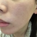 성림플라스틱 | 여름철 피부관리 성림몰 뉴알셀 앰플 후기