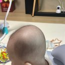 지오크리에이티브호남지사 | 부산 지오헬멧 6개월 단두증 교정 한달차 후기