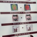 지현테라피