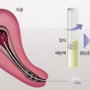 수정메디 이미지
