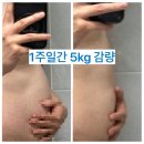 노블 | 남양주 다산동피부과 뱃살주사 노블쉐이프 효과 후기