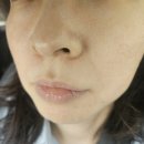 명지2단지아파트1 | 명지피부관리 올가드림뷰티 명지점 모공디톡스 관리 후기