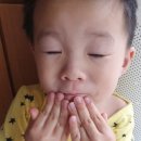 리프테라피