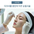 에이치에스의원 이미지