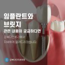 강북구치과, 임플란트와 브릿지 장단점은? 이미지