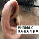 소망보청기 이미지