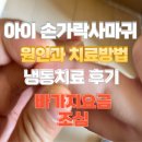 위례바른약국 | 아기 손가락 사마귀 원인과 치료방법 | 아이 사마귀 냉동치료 후기 &amp; 바가지 요금