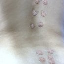 정국한의원 | 강남한의원 교통사고 뇌진탕 두통 어지러움 메스꺼움 증상 치료일기 4