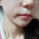 리브가유통 | 피부톤개선 수분케어 여드름피부관리 _ 리브가 스팟크림 사용후기