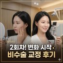 구미수한의원 | 구미후한의원 안면비대칭 치료 후기