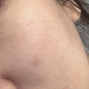 다운약국 | 포텐자 피부장벽 EGF재생크림 약국화장품으로 다운타임 줄인 후기!!