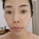 정은 에스테틱 | 니주혁신 피부관리 소하에스테틱 수분관리 후기