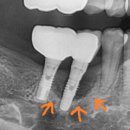 뿌리깊은치과의원 이미지