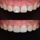 하얀치과기공소 이미지