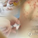 “침방울이 문제야” 또 번지는 전염병, 벌써 9천명째라는데 이미지